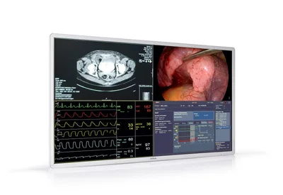 Barco MDSC-8255 54.6" 60Hz