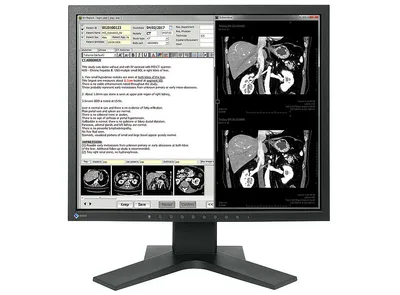 EIZO MX194