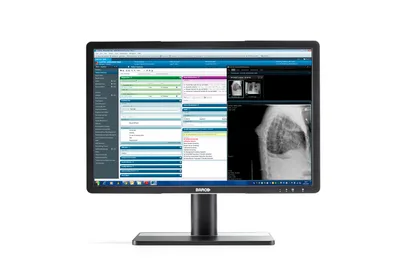 Barco MDRC-2222