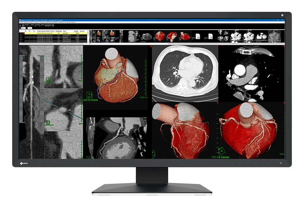 EIZO MX317W