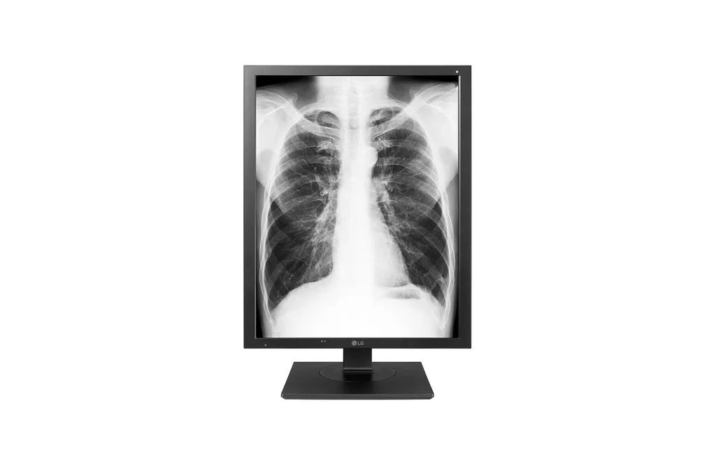 LG 21HK512D-W