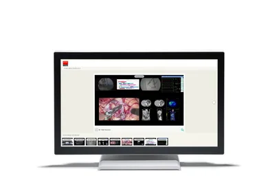 Barco 215ETTWZE