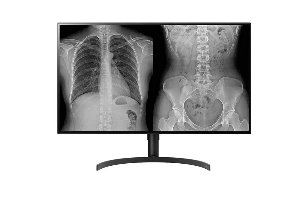 LG 32HL512D-M