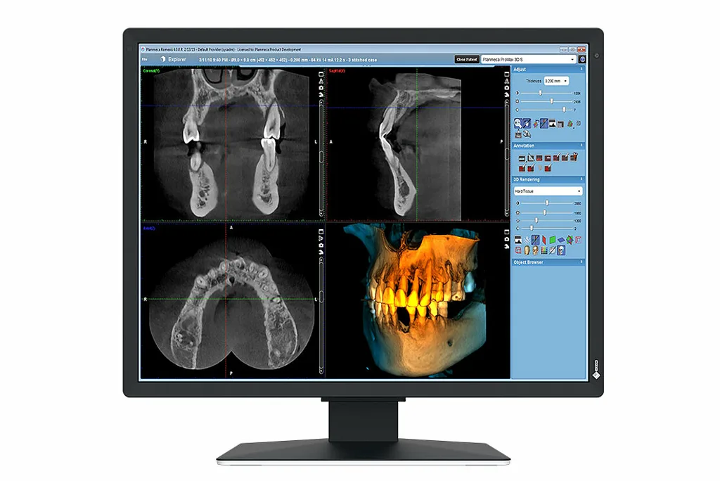 EIZO MX217-SB